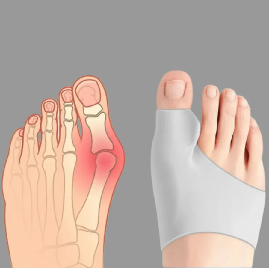 CompressCare Teen - Hallux Valgus corrector for teenagers | Pain-free & discreetly wearable - Image 5