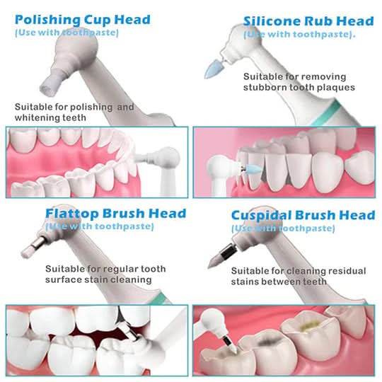 DENTASONIC – Ultrasound Tooth Cleaner for Deep Cleaning & Radiant Smile - Image 6
