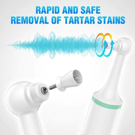 DENTASONIC – Ultrasound Tooth Cleaner for Deep Cleaning & Radiant Smile - Image 9