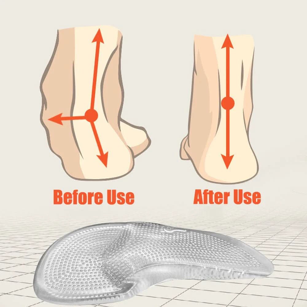 FASCIAFIX – Orthopedic Gel Insoles for Relief from Plantar Fasciitis - Image 6
