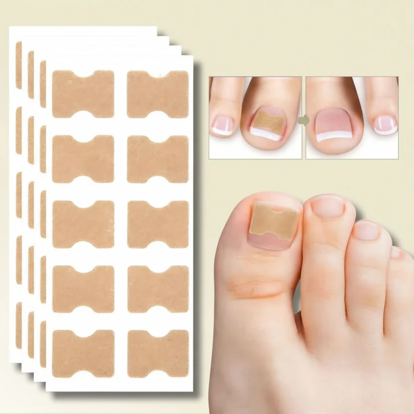 FixaNail - Gentle nail correction against ingrown nails & pain