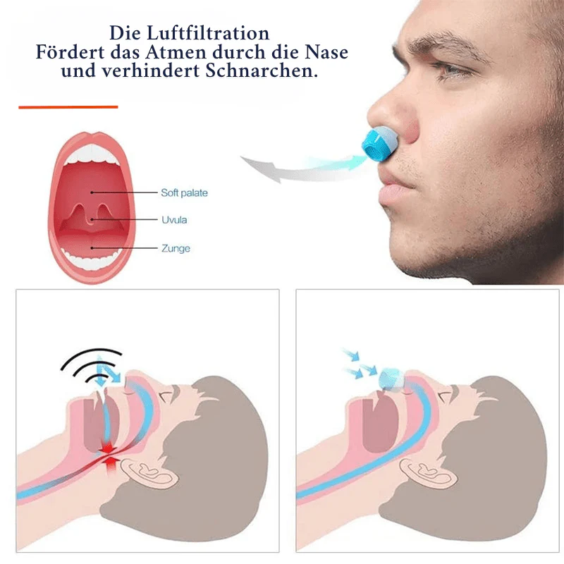 Sleeppure - Anti-snoring air filter system for better sleep & healthy breathing - Image 4