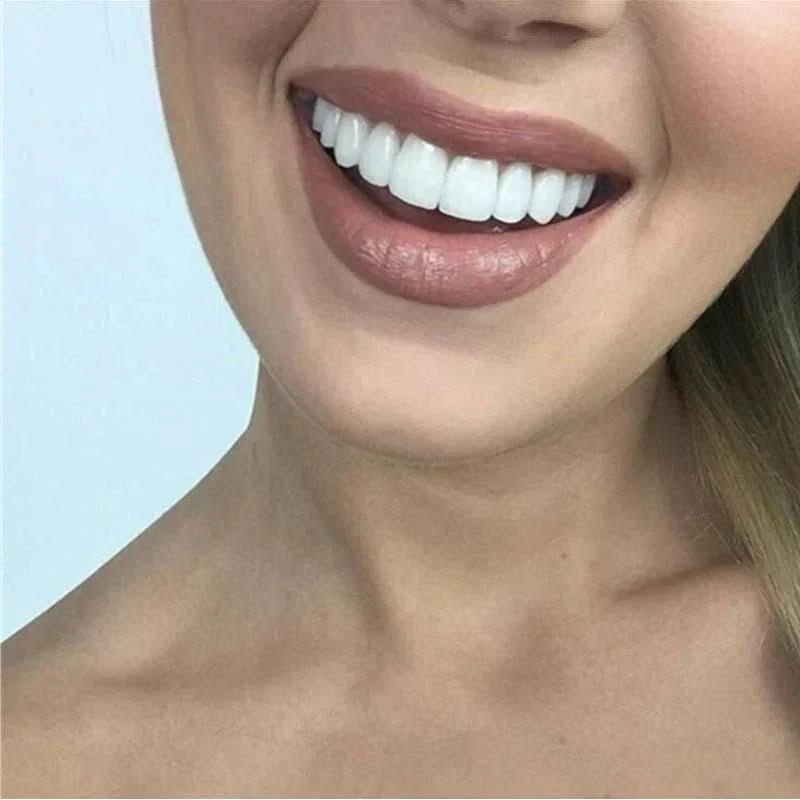 SnapFit Smile - tooth restoration for a perfect smile without a visit to the dentist - Image 3