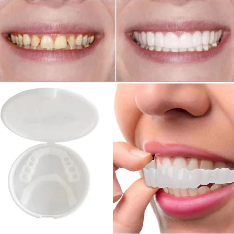 SnapFit Smile - tooth restoration for a perfect smile without a visit to the dentist - Image 4