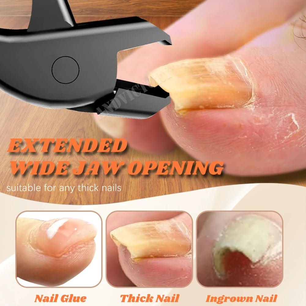 TRIMTECH – Precision Nail Clipper for Effortless Care - Image 3